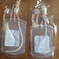 臭氧大自血：一次性塑料血袋，一次性采血回输器